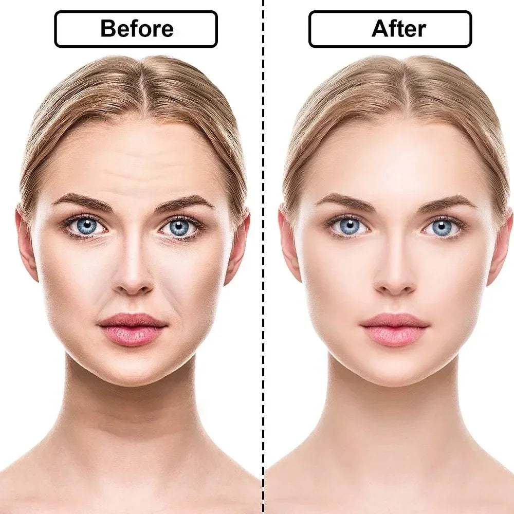 Silicone Anti-Wrinkle Lift Patches